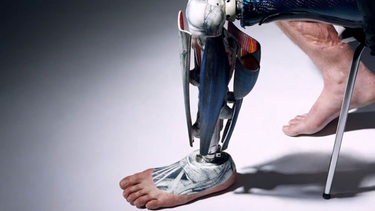 Prosthetics